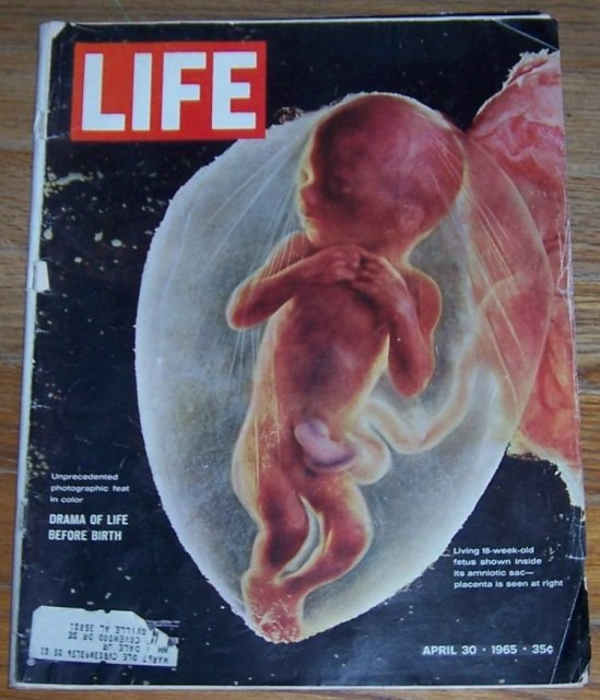 Life Magazine April 30, 1965 Drama of Life Before Birth on cover