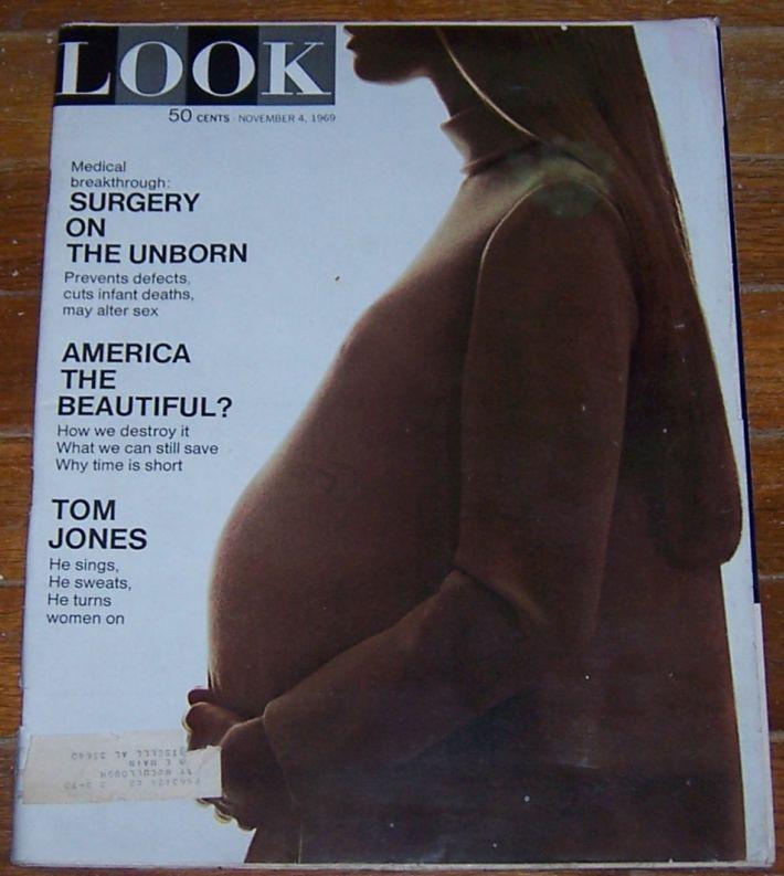 Look Magazine November 4, 1969 Surgery on the Unborn on cover/Tom Jones
