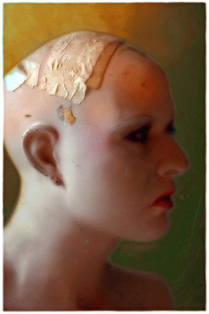 Rebecca Martinez: Head Injured