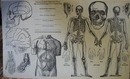 Illinois Central RR Surgeons Report of Injuries Sheet