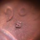 LINCOLN CENT