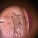 LINCOLN CENT