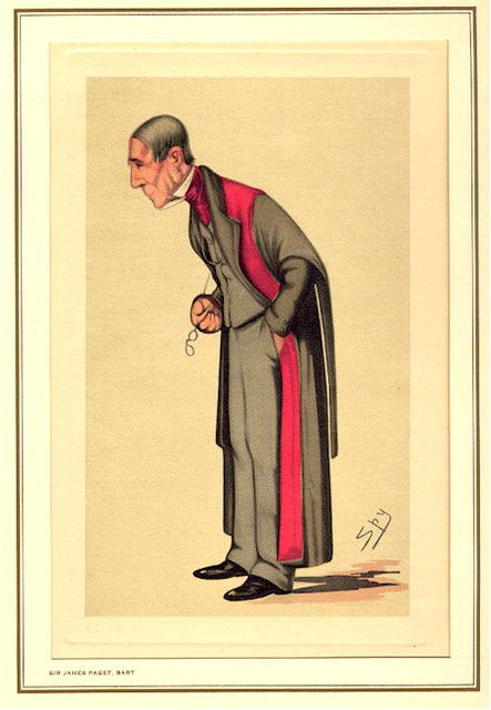 19th Century Spy Caricature, Sir James Paget,